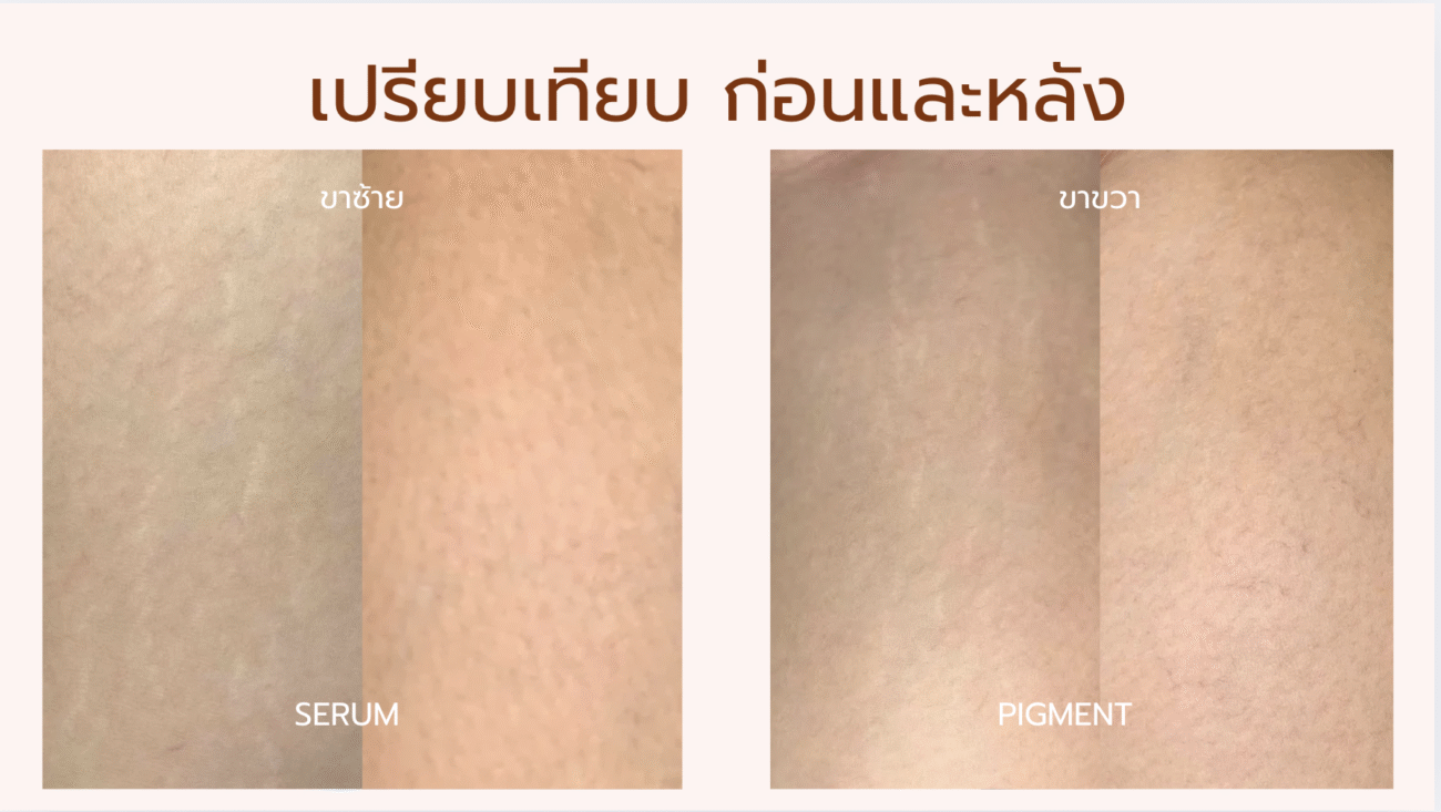 Before & After Pigment Serum