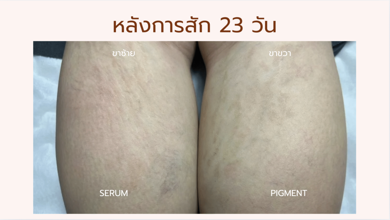 Before & After Pigment Serum