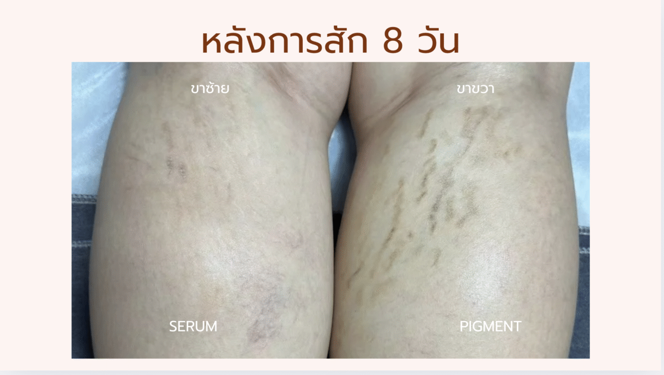 Before & After Pigment Serum
