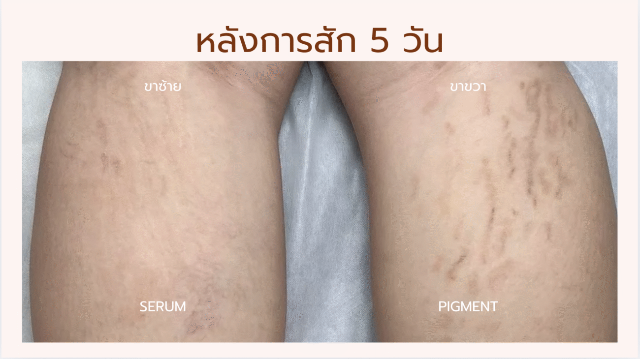 Before & After Pigment Serum