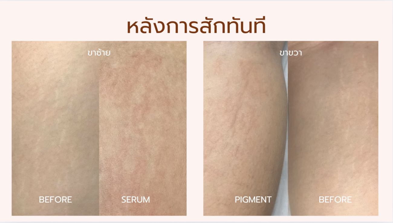 Before & After Pigment Serum